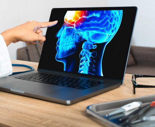 What Are Subtle Signs of Traumatic Brain Injury?